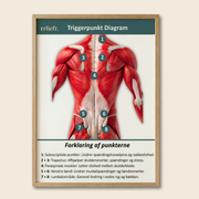 Diagramma dei trigger point