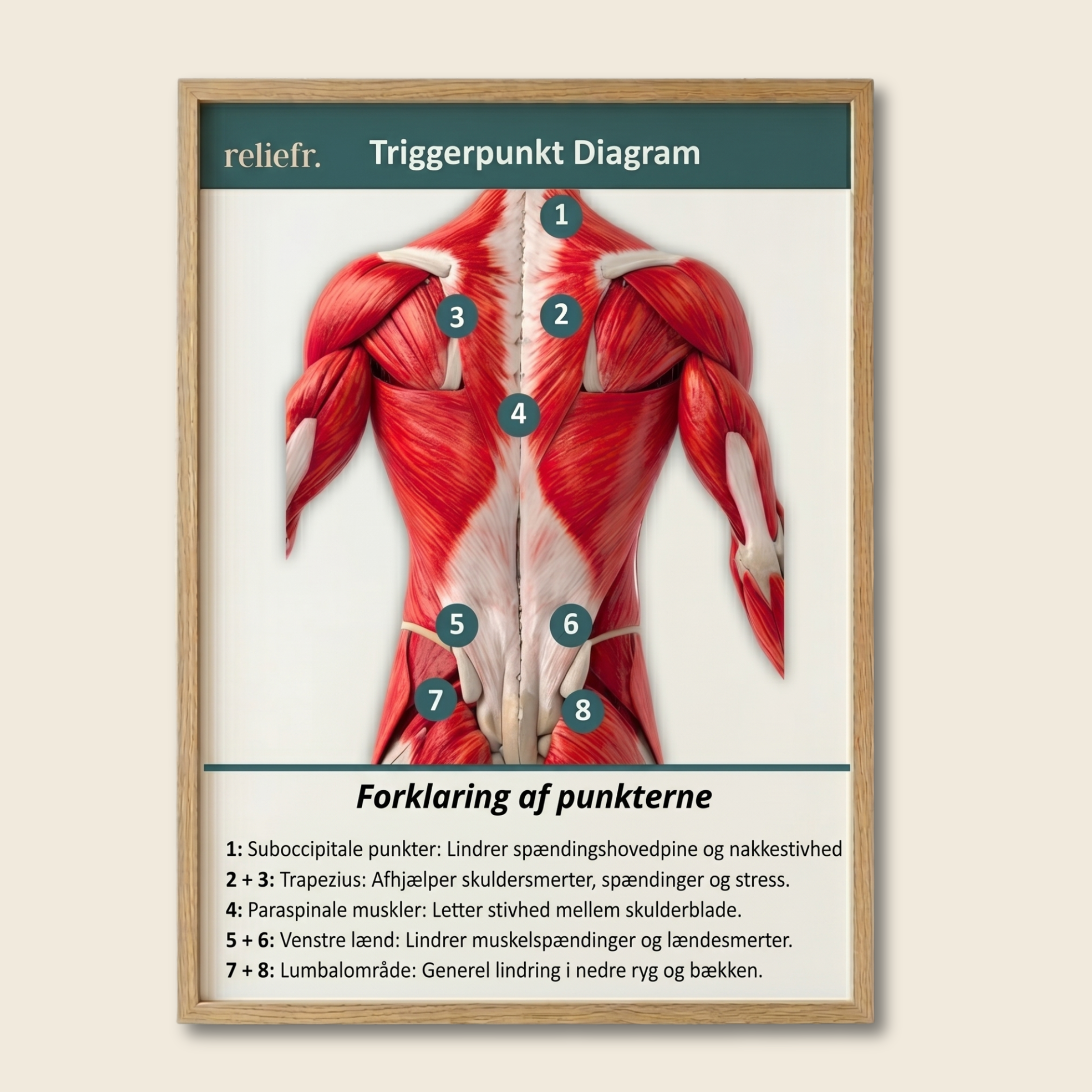Diagramma dei trigger point